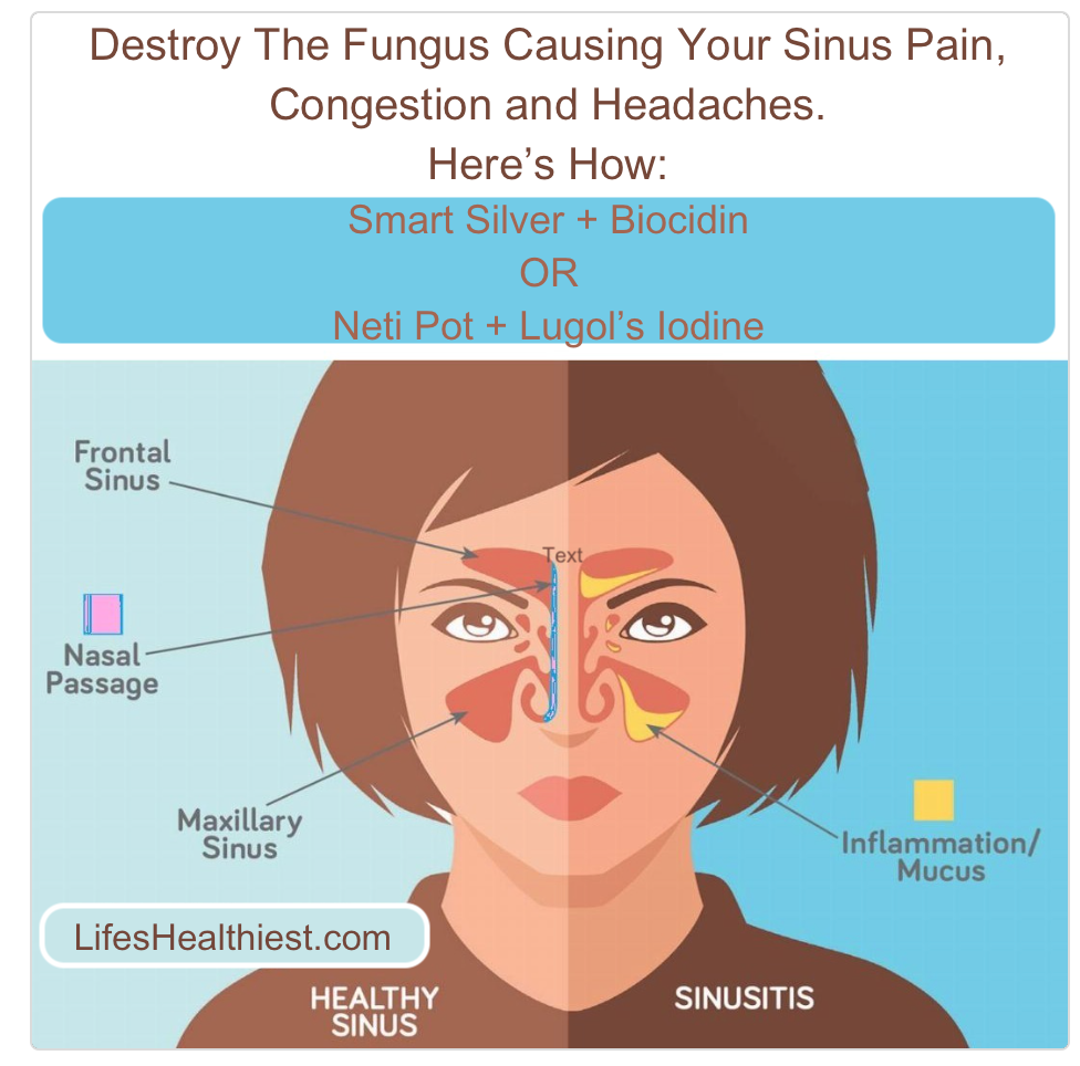 Mold-Fungus-Marcons (Sinus/Nasal Cavity)